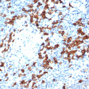 IHC analysis of formalin-fixed, paraffin-embedded human tonsil. Strong cytoplasmic and membranous staining using rCD38/6447 at 2ug/ml in PBS for 30min RT. HIER: Tris/EDTA, pH9.0, 45min. 2°C: HRP-polymer, 30min. DAB, 5min.