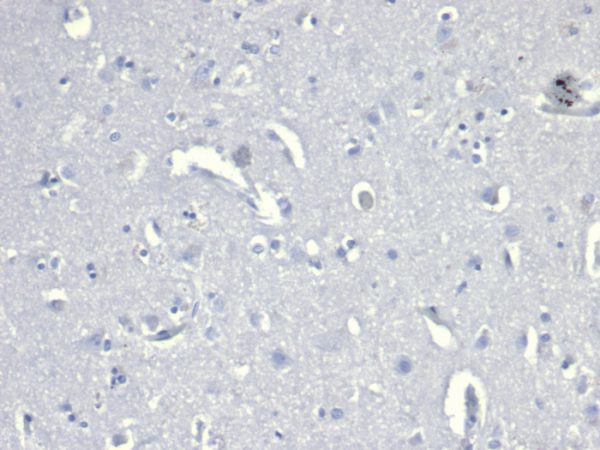 IHC analysis of formalin-fixed, paraffin-embedded human brain. Negative tissue control using rCD38/6447 at 2ug/ml in PBS for 30min RT. HIER: Tris/EDTA, pH9.0, 45min. 2°C: HRP-polymer, 30min. DAB, 5min.