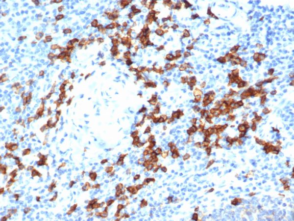 IHC analysis of formalin-fixed, paraffin-embedded human tonsil. Strong cytoplasmic and membranous staining using CD38/6448R at 2ug/ml in PBS for 30min RT. HIER: Tris/EDTA, pH9.0, 45min. 2 °: HRP-polymer, 30min. DAB, 5min.