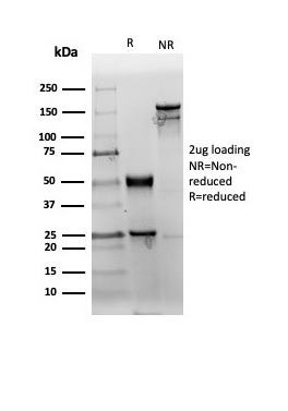 SDS-PAGE Analysis Purified CD38 Recombinant Rabbit Monoclonal Antibody (CD38/6448R). Confirmation of Purity and Integrity of Antibody.