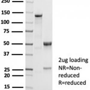 SDS-PAGE Analysis of Purified CD38 Recombinant Rabbit Monoclonal Antibody (CD38/7017R). Confirmation of Purity and Integrity of Antibody.