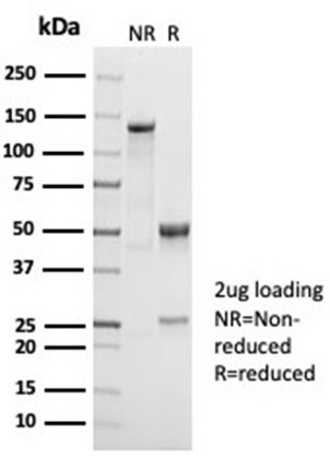 SDS-PAGE Analysis Purified CD38 Recombinant Rabbit Monoclonal Antibody (CD38/7017R). Confirmation of Purity and Integrity of Antibody.