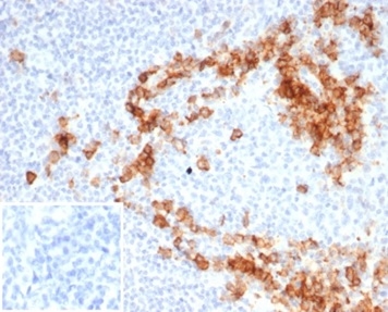 Formalin-fixed, paraffin-embedded human tonsil stained with CD38 Recombinant Rabbit Monoclonal Antibody (CD38/7017R). Inset: PBS instead of primary antibody; secondary only negative control.