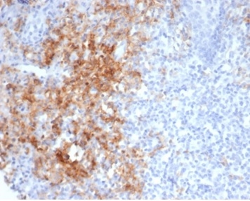 Formalin-fixed, paraffin-embedded human tonsil stained with CD38 Recombinant Rabbit Monoclonal Antibody (CD38/7017R). HIER: Tris/EDTA, pH9.0, 45min. 2 °: HRP-polymer, 30min. DAB, 5min.