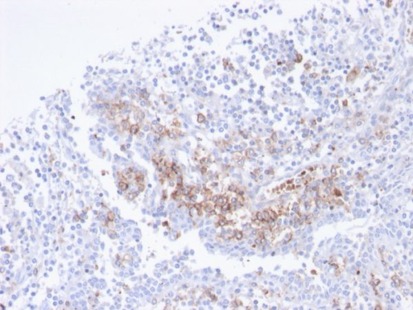 Formalin-fixed, paraffin-embedded human tonsil stained with CD38 Recombinant Rabbit Monoclonal Antibody (CD38/4247R).