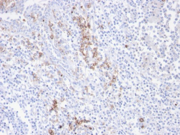 Formalin-fixed, paraffin-embedded human tonsil stained with CD38 Recombinant Rabbit Monoclonal Antibody (CD38/4247R).
