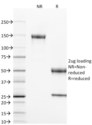 SDS-PAGE Analysis of Purified CD40 Mouse Monoclonal Antibody (T8P2G4*A6). Confirmation of Integrity and Purity of Antibody.
