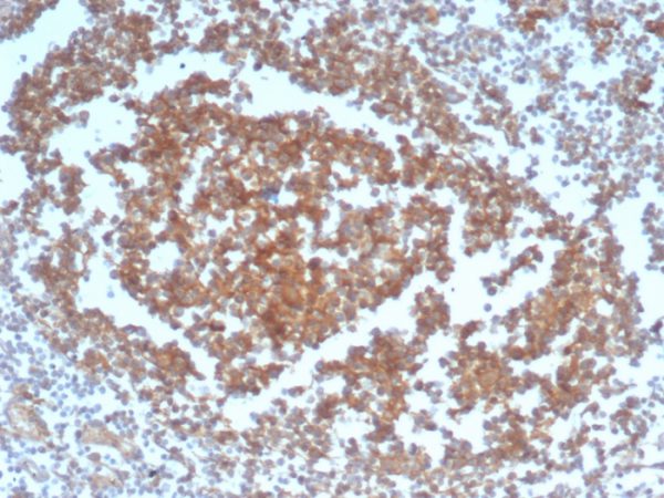 Formalin-fixed, paraffin-embedded human tonsil stained with CD40 Recombinant Rabbit Monoclonal Antibody (C40/4826R).
