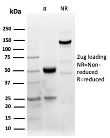 SDS-PAGE Analysis Purified CD40 Recombinant Rabbit Monoclonal Antibody (C40/4826R). Confirmation of Integrity and Purity of Antibody.
