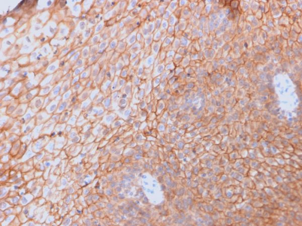 Formalin-fixed, paraffin-embedded human Spleen stained with CD40L-Monospecific Mouse Monoclonal Antibody (CD40LG/2761).