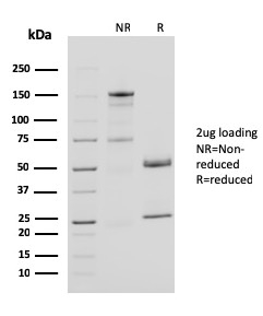 SDS-PAGE Analysis Purified CD40L Mouse Monoclonal Antibody (CD40LG/2761). Confirmation of Purity and Integrity of Antibody.