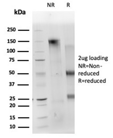SDS-PAGE Analysis of Purified CD40L-Monospecific Mouse Monoclonal Antibody (CD40LG/4675). Confirmation of Purity and Integrity of Antibody. CD40 Ligand / CD154 / TRAP1 (Activation Marker of T-Lymphocytes) Antibody - Image 3