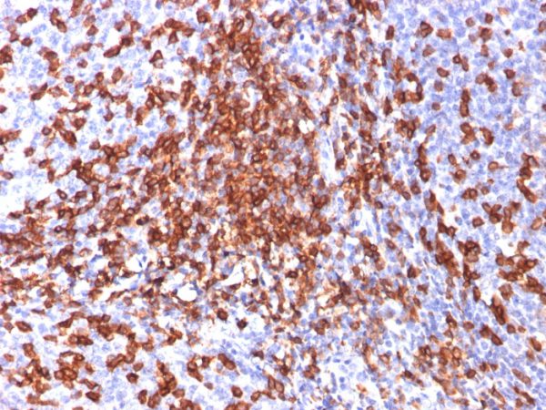 Formalin-fixed, paraffin-embedded human Tonsil stained with CD44 Mouse Monoclonal Antibody (156-3C11).