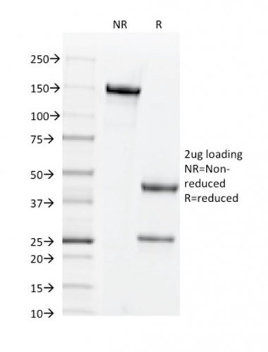 SDS-PAGE Analysis of Purified CD44v6 Mouse Monoclonal Antibody (2F10). Confirmation of Purity and Integrity of Antibody.