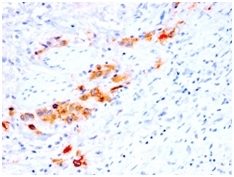 Formalin-fixed, paraffin-embedded human Bladder stained with CD44v4 Mouse Recombinant Monoclonal Antibody (rCD44v4/1219).