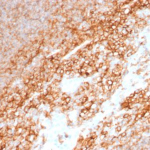 Formalin-fixed, paraffin-embedded human Tonsil stained with CD44 Mouse Monoclonal Antibody (BU75).