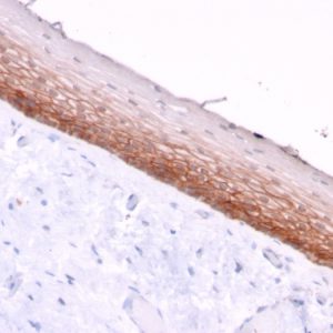 Formalin-fixed, paraffin-embedded human Cervix stained with CD44v4/5 Mouse Monoclonal Antibody (3D2).
