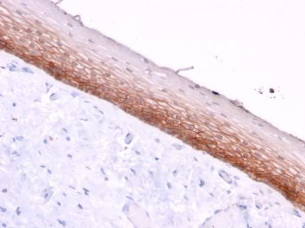 Formalin-fixed, paraffin-embedded human Cervix stained with CD44v4/5 Mouse Monoclonal Antibody (3D2).