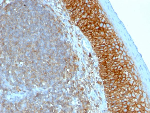 Formalin-fixed, paraffin-embedded human Tonsil stained with CD44 Mouse Monoclonal Antibody (SPM521).