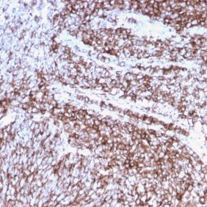 Formalin-fixed, paraffin-embedded human cervix stained with CD44 Recombinant Mouse Monoclonal Antibody (rHCAM/918).