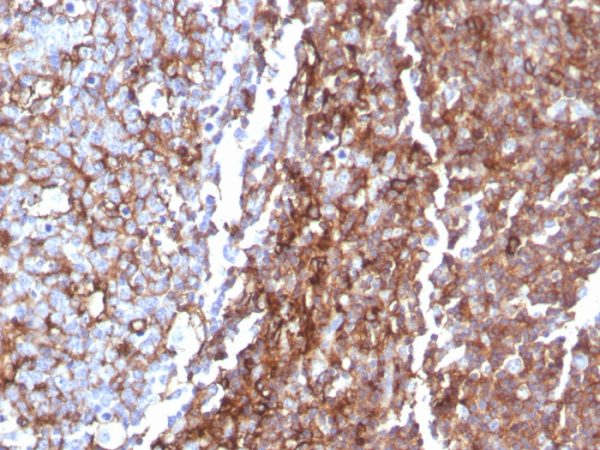 Formalin-fixed, paraffin-embedded human tonsil stained with CD44 Recombinant Mouse Monoclonal Antibody (rHCAM/918).