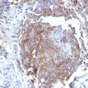 Formalin-fixed, paraffin-embedded human breast stained with CD44 Recombinant Mouse Monoclonal Antibody (rHCAM/6449).