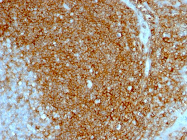 Formalin-fixed, paraffin-embedded human Tonsil stained with CD44 Monoclonal Antibody (HCAM/1097)