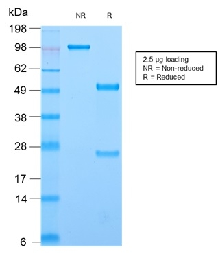 SDS-PAGE Analysis of Purified CD44 Rabbit Recombinant Monoclonal Antibody (HCAM/2875R). Confirmation of Integrity and Purity of Antibody.