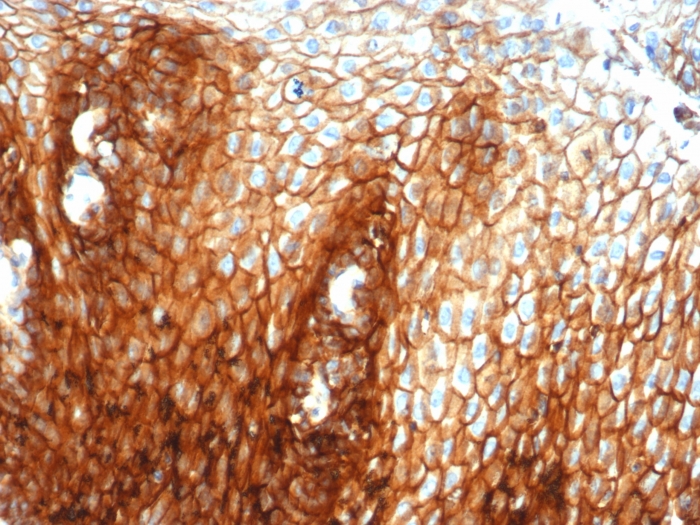 Formalin-fixed, paraffin-embedded human esophagus stained with CD44 Recombinant Rabbit Monoclonal Antibody (HCAM/6459R). Recombinant CD44 / HCAM (Cancer Stem Cell Marker) Antibody