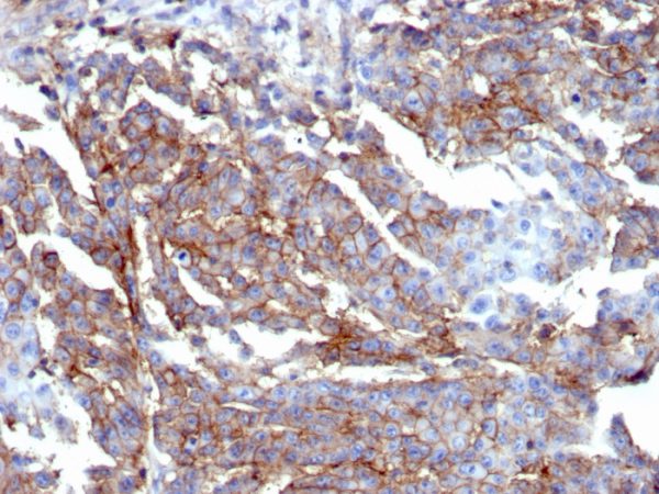 Formalin-fixed, paraffin-embedded human breast stained with CD44 Recombinant Rabbit Monoclonal Antibody (HCAM/6459R).