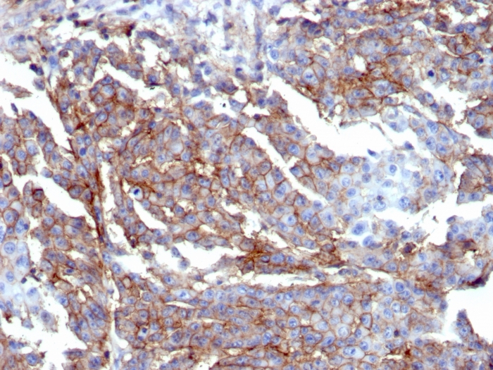 Formalin-fixed, paraffin-embedded human breast stained with CD44 Recombinant Rabbit Monoclonal Antibody (HCAM/6459R). Recombinant CD44 / HCAM (Cancer Stem Cell Marker) Antibody - Image 2