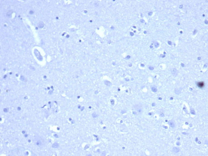IHC analysis of formalin-fixed, paraffin-embedded human brain. Negative tissue control using HCAM/6459R at 2ug/ml in PBS for 30min RT. HIER: Tris/EDTA, pH9.0, 45min. 2°C: HRP-polymer, 30min. DAB, 5min. Recombinant CD44 / HCAM (Cancer Stem Cell Marker) Antibody - Image 3