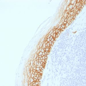 Formalin-fixed, paraffin-embedded human Tonsil stained with CD44v9 Rabbit Recombinant Monoclonal Antibody (CD44v9/2344R).