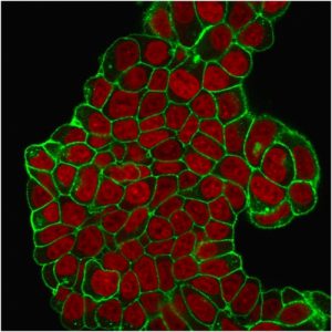 Immunofluorescent staining of PFA-fixed MCF-7 cells. CD47 Mouse Monoclonal Antibody (B6H12.2) followed by goat anti-Mouse IgG-CF488 (green). Nuclei are stained with Redot (red).