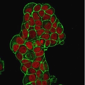 Immunofluorescence Analysis of PFA-fixed MCF-7 cells. CD47 Mouse Monoclonal Antibody (IAP/964) followed by goat anti-mouse IgG-CF488 (green). The nuclear counterstain is RedDot (red).