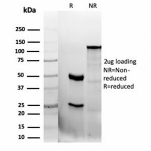 SDS-PAGE Analysis of Purified CD47 Recombinant Rabbit Monoclonal Antibody (CD47/6362R). Confirmation of Integrity and Purity of Antibody.