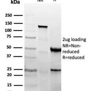 SDS-PAGE Analysis Purified CD47 Recombinant Rabbit Monoclonal Antibody (CD47/6364R). Confirmation of Integrity and Purity of Antibody.