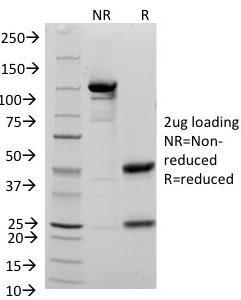 SDS-PAGE Analysis of Purified CD48 Mouse Monoclonal Antibody (156-4H9). Confirmation of Purity and Integrity of Antibody.