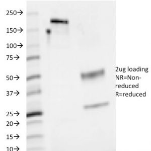 SDS-PAGE Analysis of Purified CD48 Mouse Monoclonal Antibody (5-4.8). Confirmation of Purity and Integrity of Antibody.