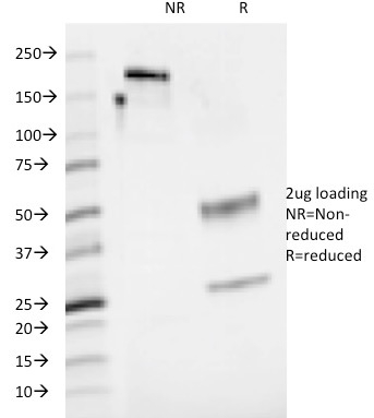SDS-PAGE Analysis Purified CD48 Mouse Monoclonal Antibody (5-4.8). Confirmation of Purity and Integrity of Antibody.