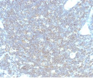 Formalin-fixed, paraffin-embedded human lymph node stained with CD48-Monospecific Mouse Monoclonal Antibody (CD48/4783) at 2ug/ml. HIER: Tris/EDTA, pH9.0, 45min. 2°C: HRP-polymer, 30min. DAB, 5min.