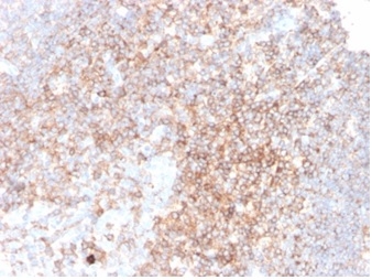 Formalin-fixed, paraffin-embedded human tonsil stained with CD48-Monospecific Mouse Monoclonal Antibody (CD48/4783) at 2ug/ml. HIER: Tris/EDTA, pH9.0, 45min. 2°C: HRP-polymer, 30min. DAB, 5min. CD48 (Pan Leukocyte Marker) Antibody - Image 2