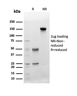 SDS-PAGE Analysis of Purified CD48 Mouse Monoclonal Antibody (CD48/4783). Confirmation of Purity and Integrity of Antibody. CD48 (Pan Leukocyte Marker) Antibody - Image 4