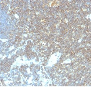 Formalin-fixed, paraffin-embedded human lymph node stained with CD48 Mouse Monoclonal Antibody (CD48/4786).