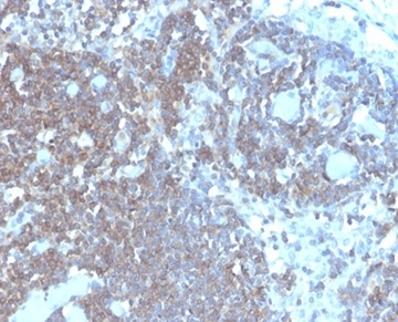 Formalin-fixed, paraffin-embedded human lymph node stained with CD48 Monospecific Mouse Monoclonal Antibody (CD48/4787).
