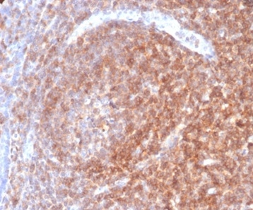 Formalin-fixed, paraffin-embedded human lymph node stained with CD48 Monospecific Mouse Monoclonal Antibody (CD48/4787).