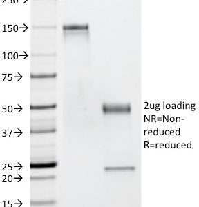 SDS-PAGE Analysis of Purified CD53 Mouse Monoclonal Antibody (63-5A3). Confirmation of Purity and Integrity of Antibody.