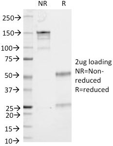 SDS-PAGE Analysis of Purified CD53 Mouse Monoclonal Antibody (161-2). Confirmation of Purity and Integrity of Antibody.