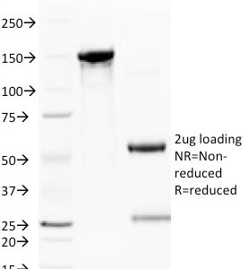 SDS-PAGE Analysis of Purified CD59 Mouse Monoclonal Antibody (BRA-10G). Confirmation of Purity and Integrity of Antibody.