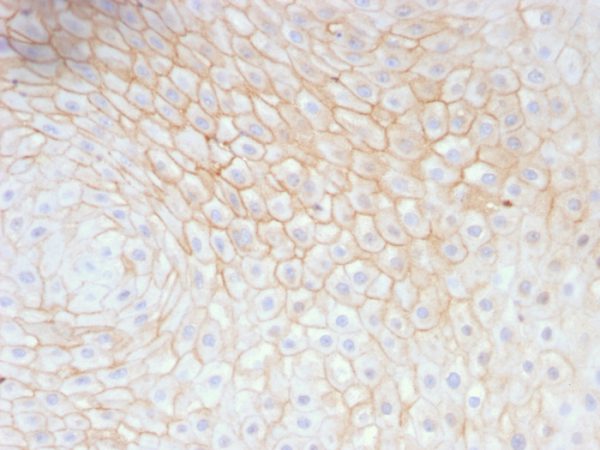 Formalin-fixed, paraffin-embedded human Tongue stained with CD59 Mouse Monoclonal Antibody (MACIF/629).